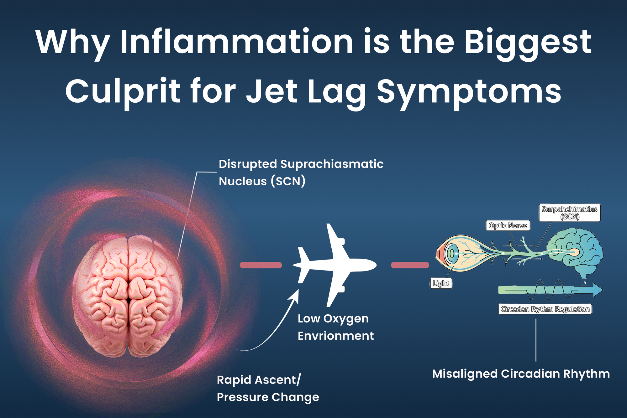 Why Inflammation is the Biggest Culprit for Jet Lag Symptoms